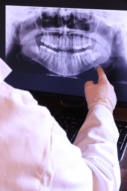 Best Weekend Emergency Dentist in Lake Goodwin, WA