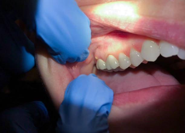 Best After-Hours Dental Trauma Care in Lake Goodwin, WA
