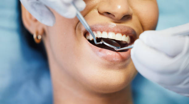 Best Urgent Care for Lost Fillings or Crowns in Lake Goodwin, WA